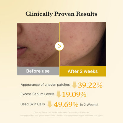 [GIFT] Kojic Acid Tumeric Toner Pad