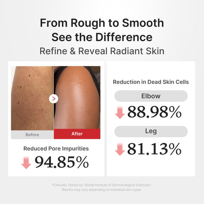 [GIFT] Hypochlorous Acid Rice Body Peel Shot